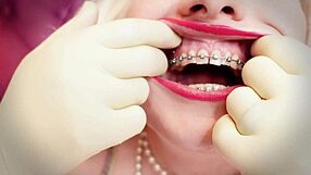 Wow! Milf in Double Gloves Shows Braces in 4K Fetish Video