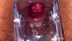 Wanna see my hairy big ass with speculum?