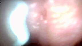 endoscope reveals penis weak spots for ultimate humiliation tease